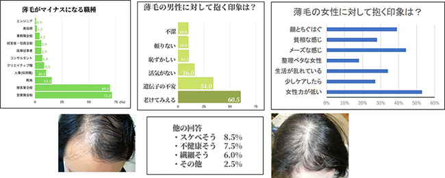 薄毛の印象