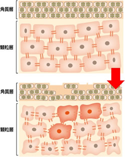 ストレスを受けた細胞